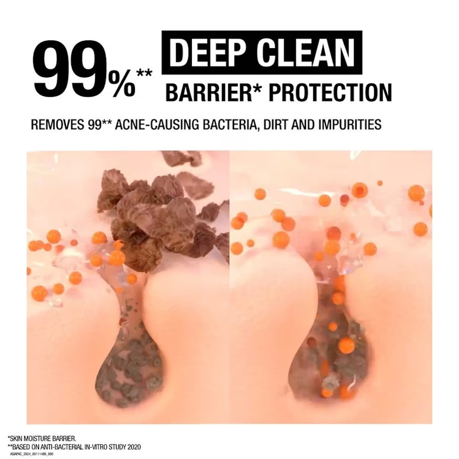 NEUTROGENA Deep Clean Acne Foaming Cleanser (For Acne Prone Skin)100g