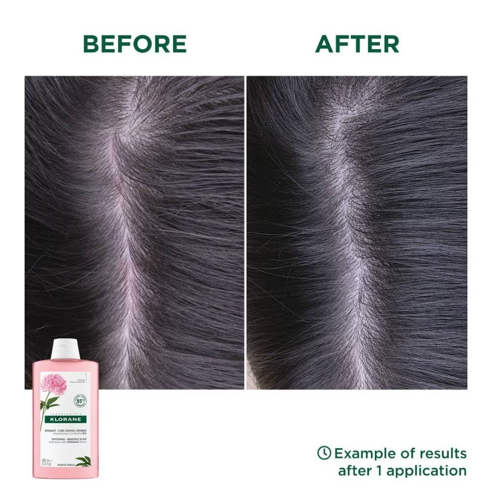 Klorane Soothing Shampoo with Organic Peony - Sensitive scalp 400ml