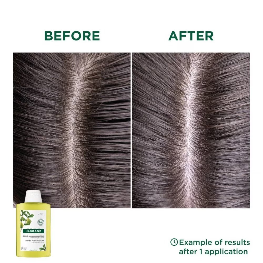 Klorane Purifying Citrus Shampoo (To Cleanses & Purifies Scalp, For Normal To Oily Hair) 400ml