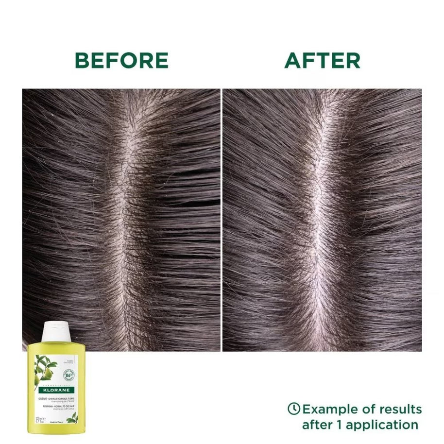 Klorane Purifying Citrus Shampoo (To Cleanses & Purifies Scalp, For Normal To Oily Hair) 400ml