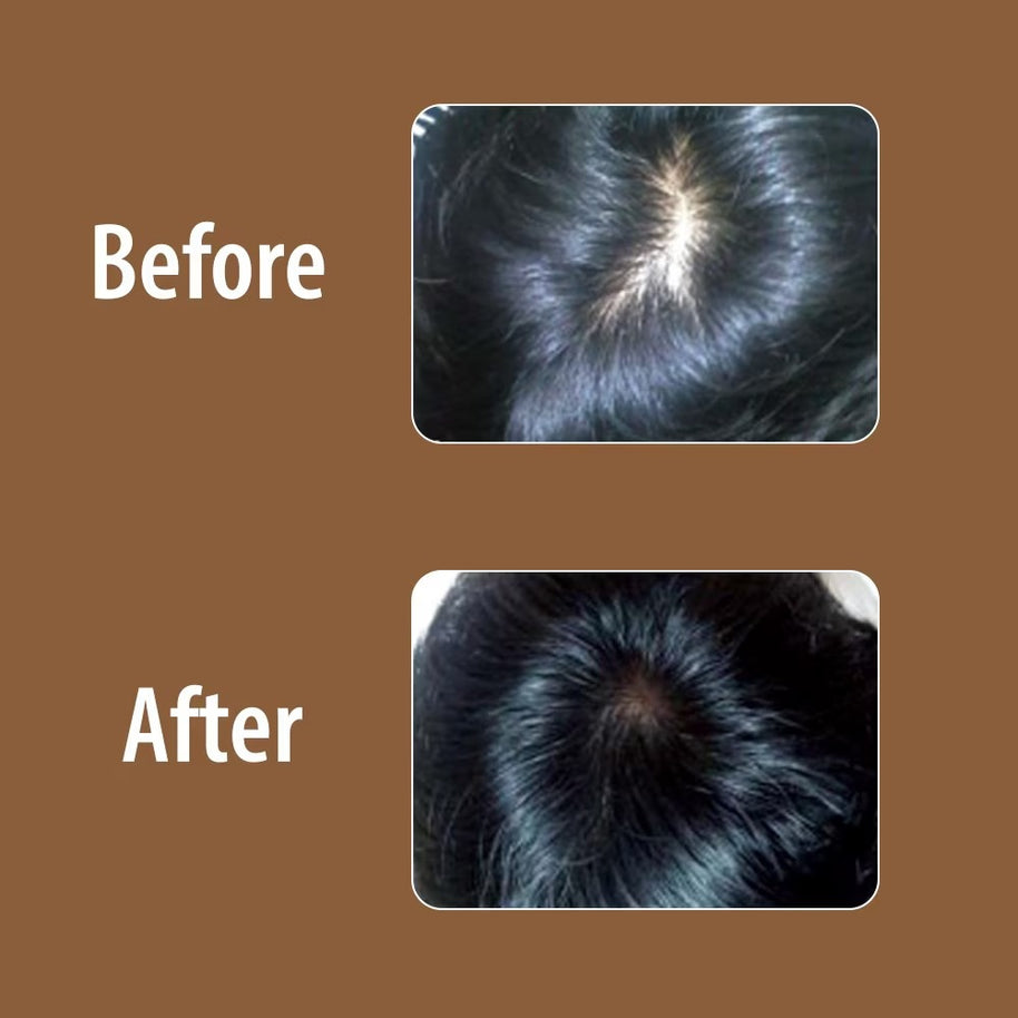 DAENG GI MEO RI Hair Loss Care Shampoo For Thinning Hair (Anti-Hair Loss + Volumizing) Fleece Flower 400ml