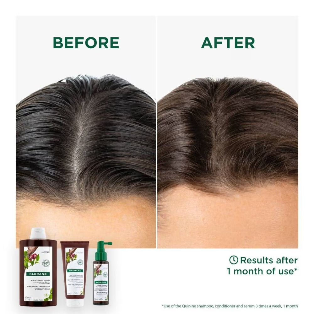 Klorane Quinine Anti-Hair Loss Strengthening & Stimulating Conditioner 200ml