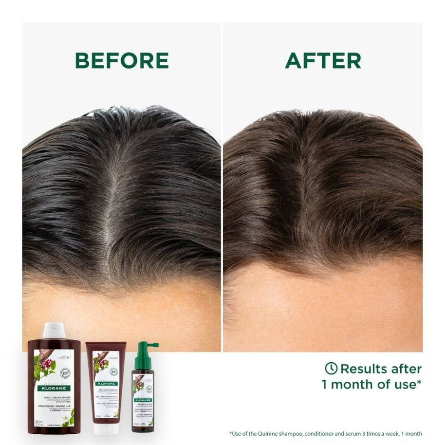 Klorane Quinine Anti-Hair Loss Strengthening & Stimulating Conditioner 200ml
