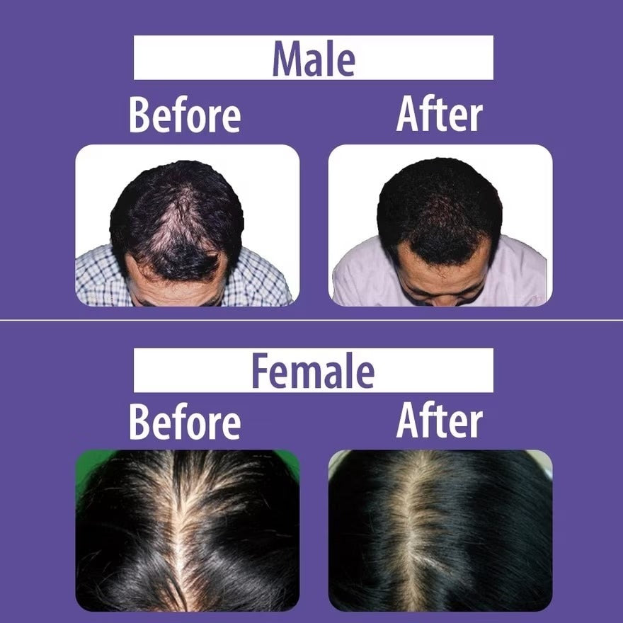 DAENG GI MEO RI - Jin Gi Vitalizing Shampoo & Conditioner 500ml - Anti Dandruff and Itchiness